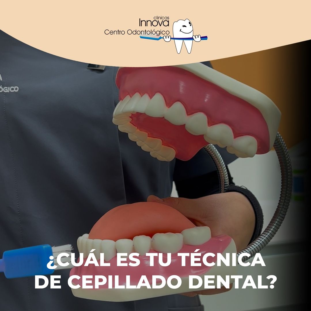 5 técnicas de cepillado dental, ¿Cuál es la tuya?