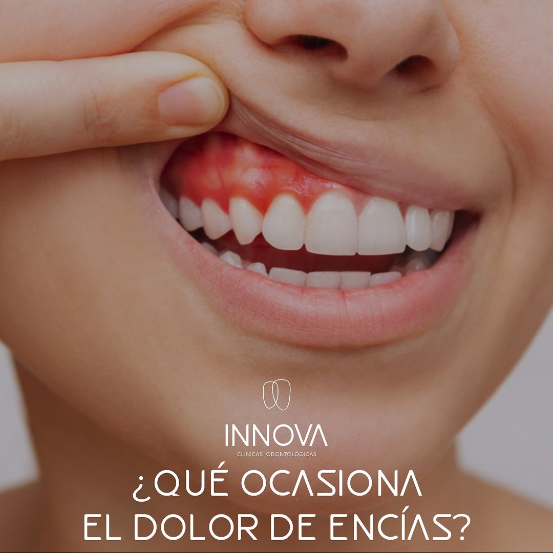 ¿Qué ocasiona el dolor de encías?