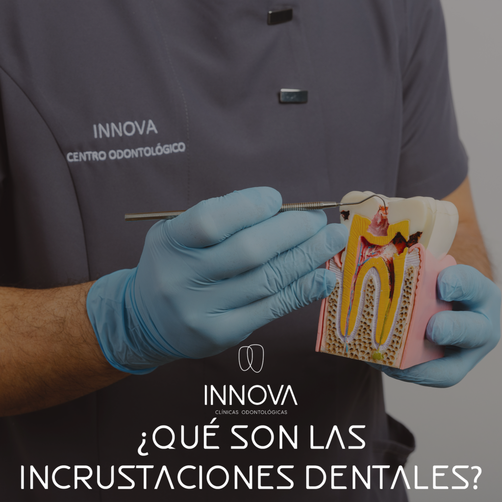 Portada Blog "¿Qué son las incrustaciones dentales?"